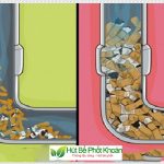 Nguyên nhân tắc nghẽn cống là do chất thải